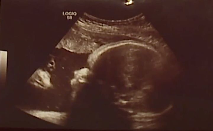 Parents Alicia Zeek and Zac Smith were startled when they saw their daughter’s sonogram photo and saw an image they believe looks like Jesus in the left hand side of the photo.