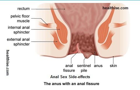 Advice On Anal Sex 102