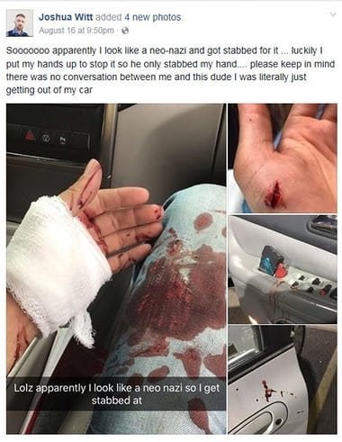 Witt posted pictures of his (self-inflicted) injuries to Facebook