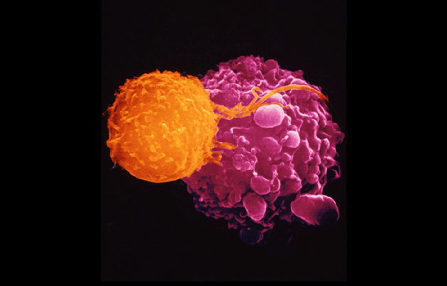 Revolutionary Gene Therapy Treatment For Cancer Gets Approval In The ...