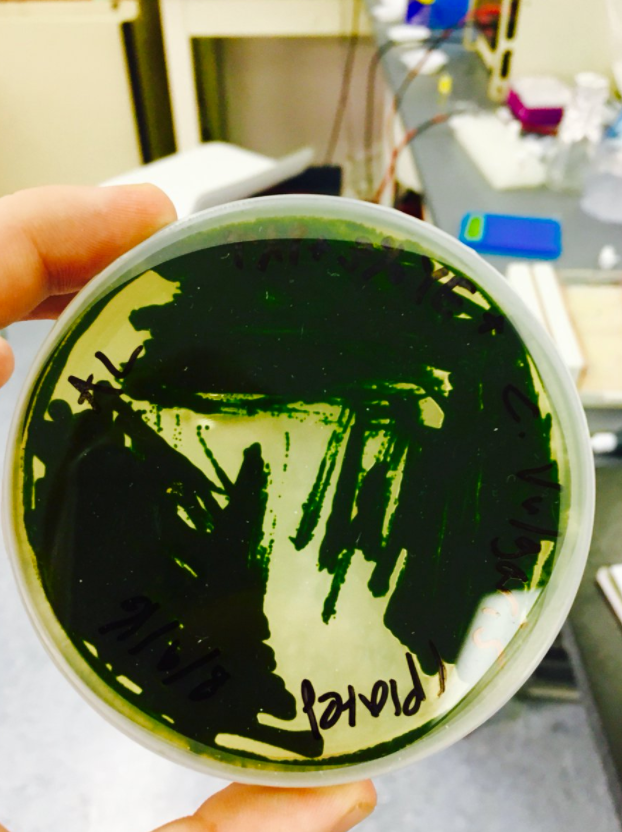<strong>Microalgae - the smallest plant in the world, soon to become the world’s first oral vaccine for aquaculture.</strong>
