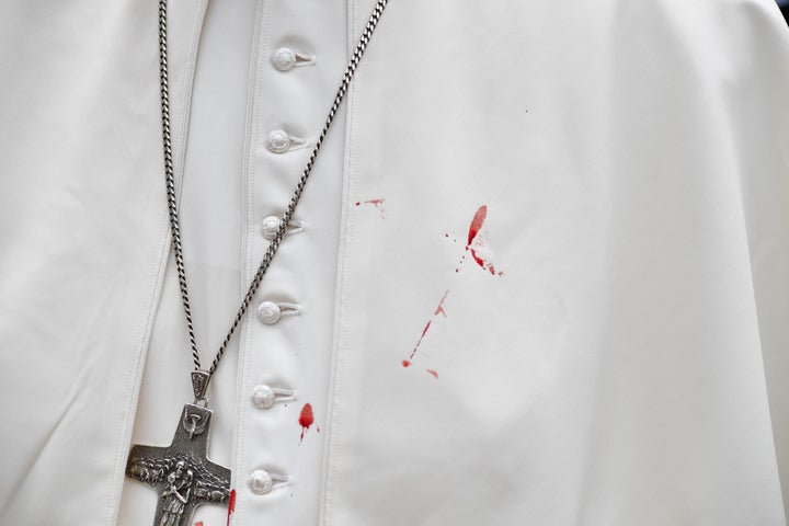 A few droplets of blood stain Pope Francis' white tunic from a bruise around his left eye and eyebrow caused by an accidental hit against the popemobile's window glass while visiting the old sector of Cartagena, Colombia, on September 10, 2017.