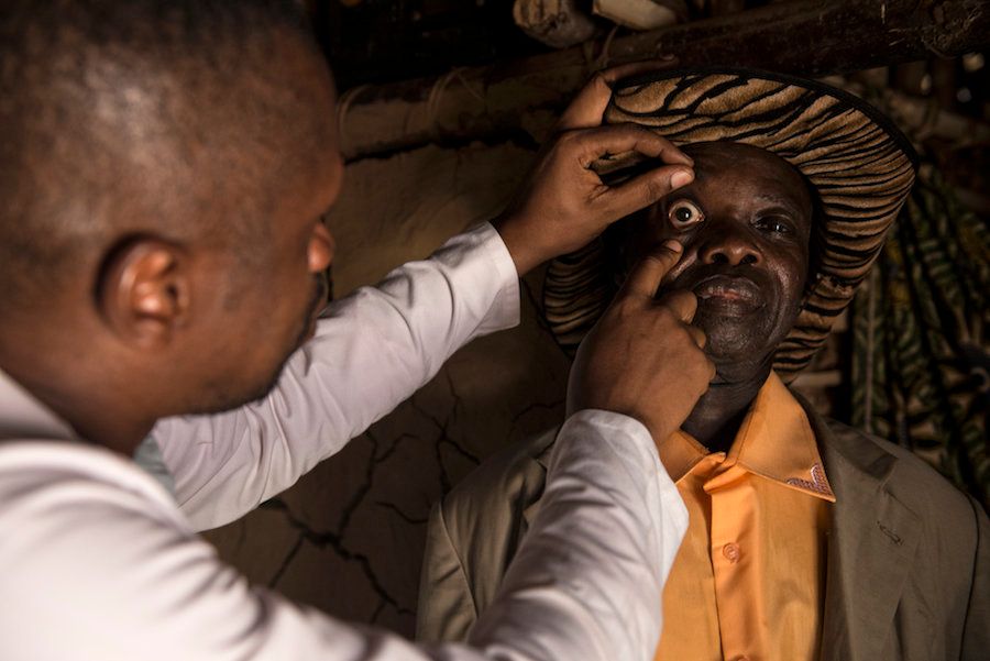 A doctor examines Baudoin for co-infections that could make it risky for him to take a drug used to fight elephantiasis.