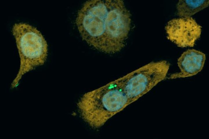 <p>Bacteria, in green, inside a pancreatic cancer cell</p>