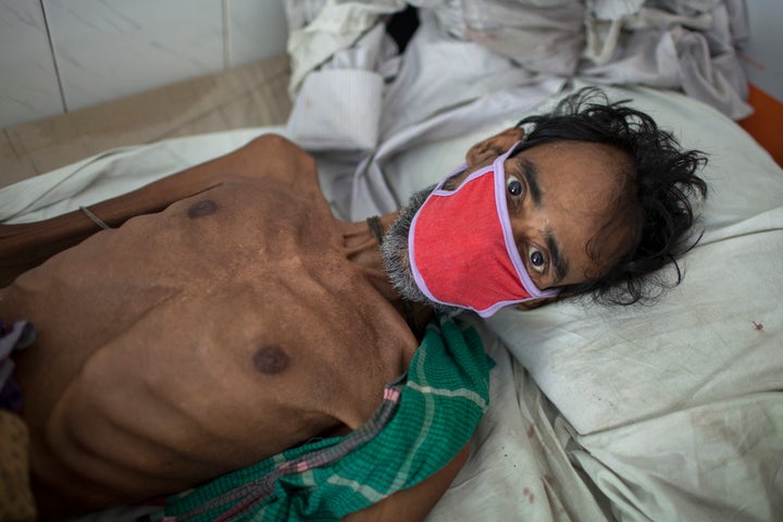 A 55-year-old tuberculosis patient in Bangladesh in 2016. It is estimated that 75 million people will die of multidrug-r