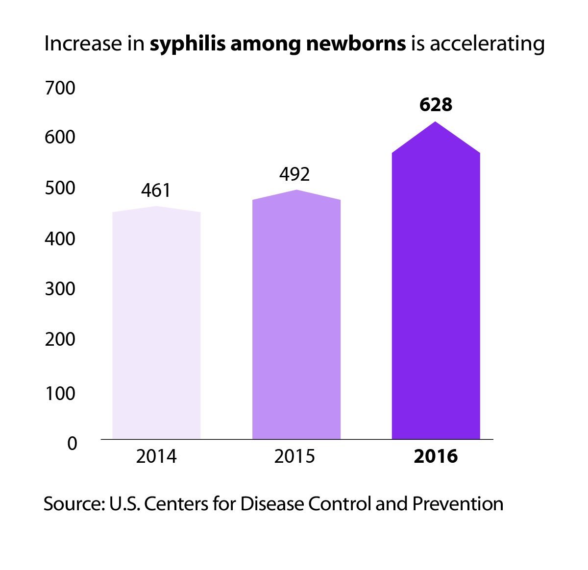 Doctors See A Surge In Babies With Syphilis-Associated Birth Defects ...