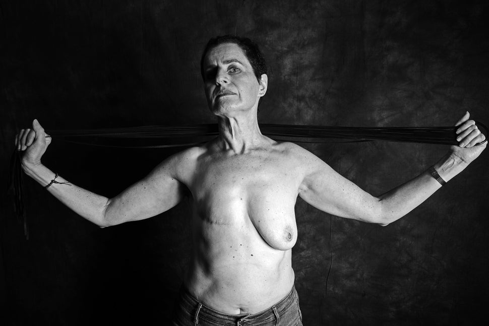 Woman after mastectomy. A girl without breasts tries on a breast