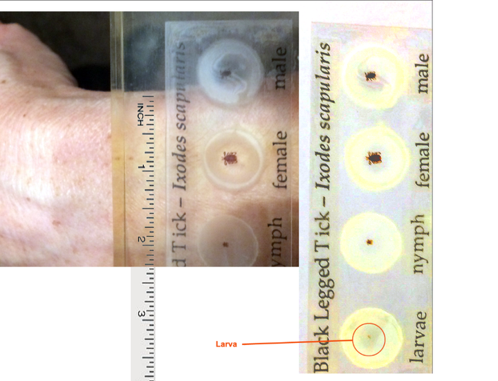 <p> Right: Stages of tick life cycle. Left: nymph and adult female against an average human wrist. </p>