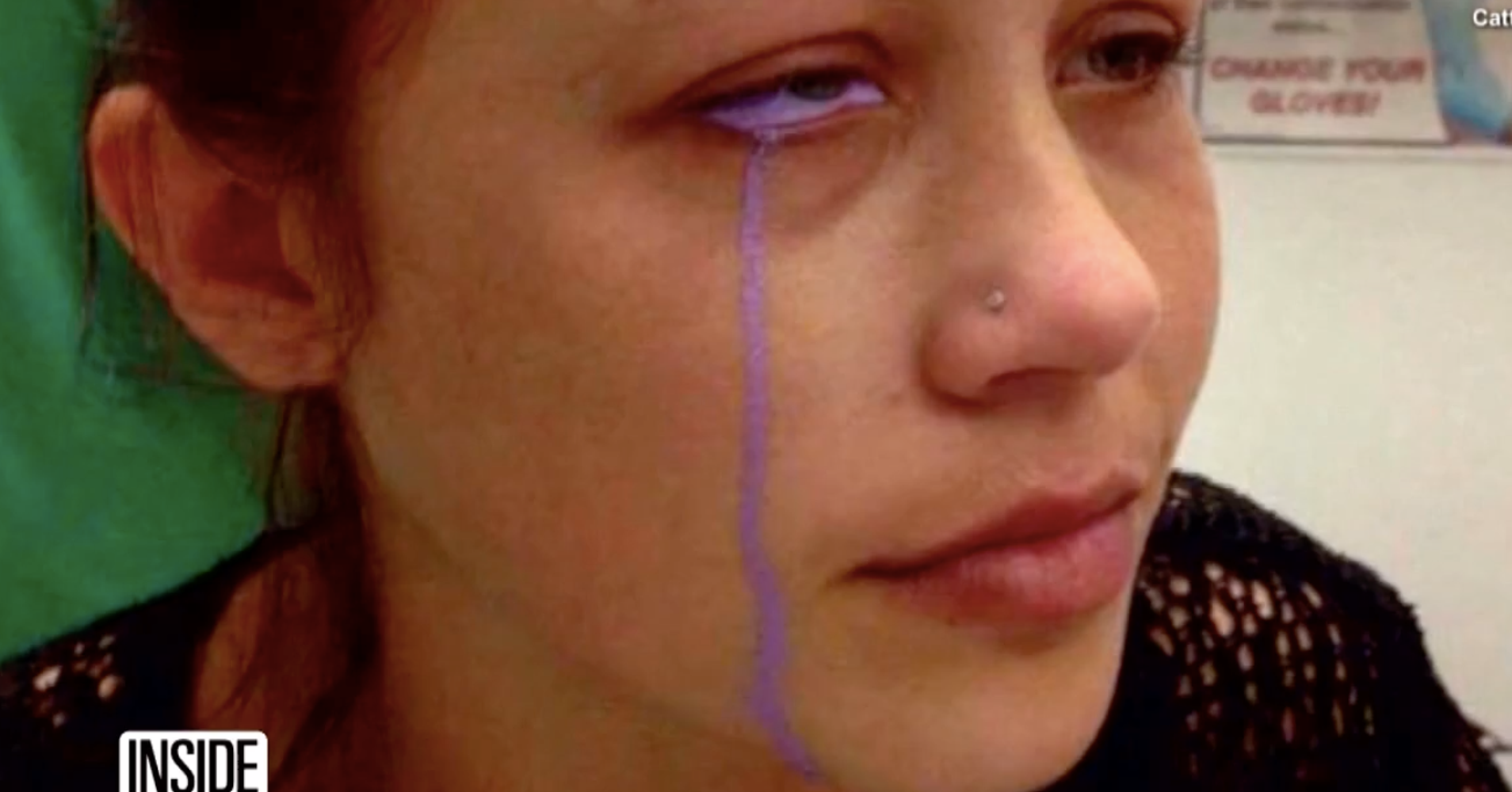 Model Awaits Surgery After Eyeball Tattoo Goes Extremely Wrong | HuffPost