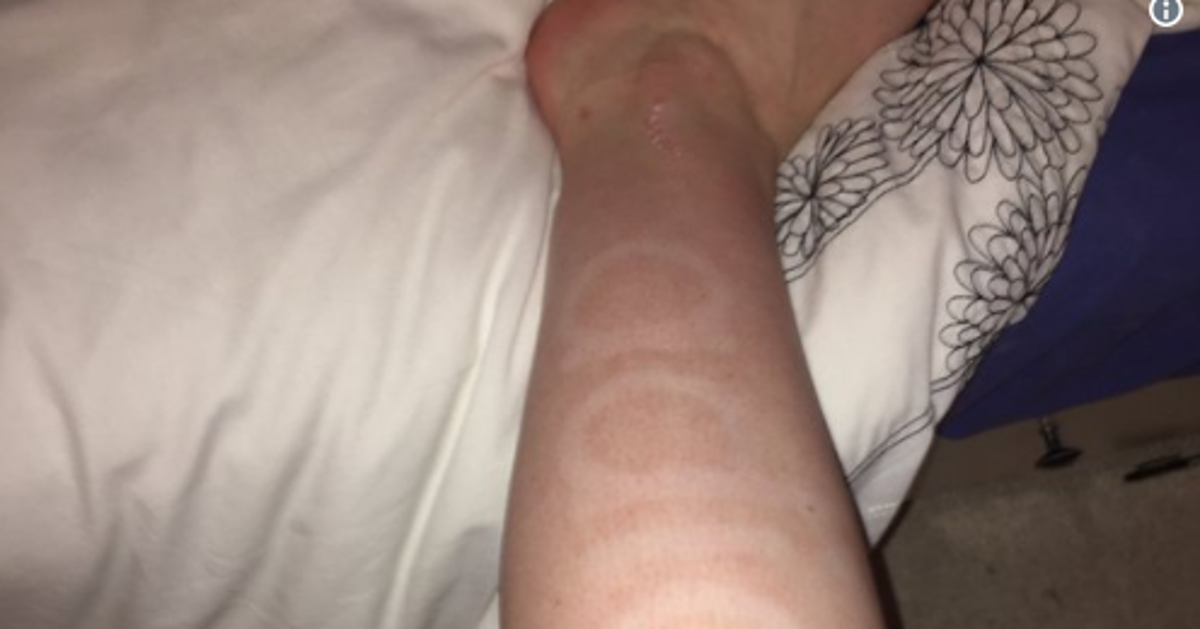 This Self-Tanner Fail Has 'Adidas' Written All Over It | HuffPost Life