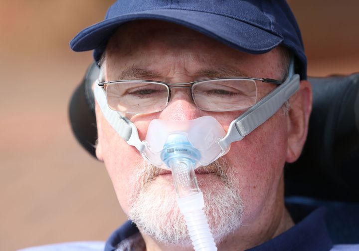Noel Conway must use a ventilator to breathe for up to 22 hours a day 