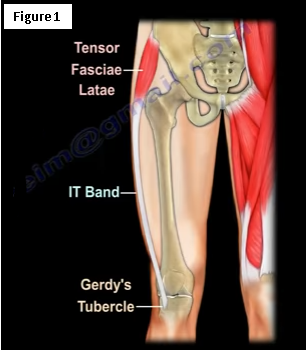 Iliotibial Band Syndrome- Around the Knee