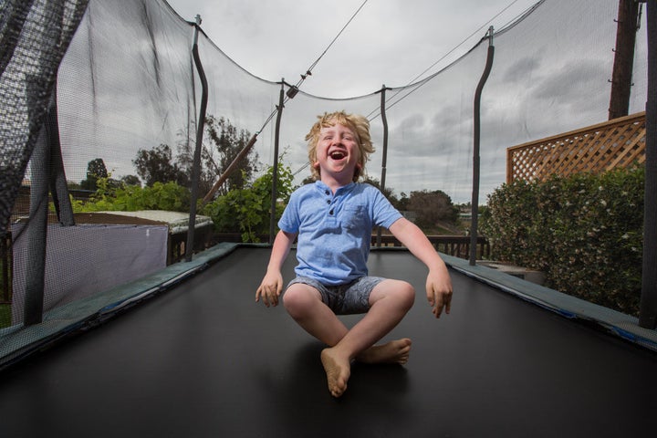 Ian is a fun-loving boy who has megalencephaly-capillary malformation syndrome (MCAP) and polymicrogyria (PMG), which involve the skin, connective tissue and brain causing a disproportionately large head and capillary malformations on the skin.