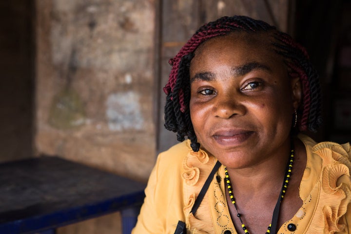 Ndidi Ekeanyawu paid a traditional healer every two weeks to drain the fluid from her legs. But she saw no improvement in her condition.