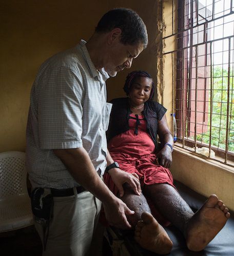 Dr. Frank Richards, director of the Carter Center's lymphatic filariasis program, examines Ndidi Ekeanyawu's legs at a health clinic.