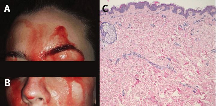 The patient (left) and her skin under a microscope (right), which showed no abnormalities. 