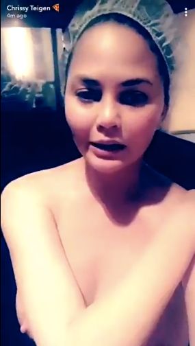 Chrissy Teigen Apologizes For Having Nipples After Accidental Nip Slip