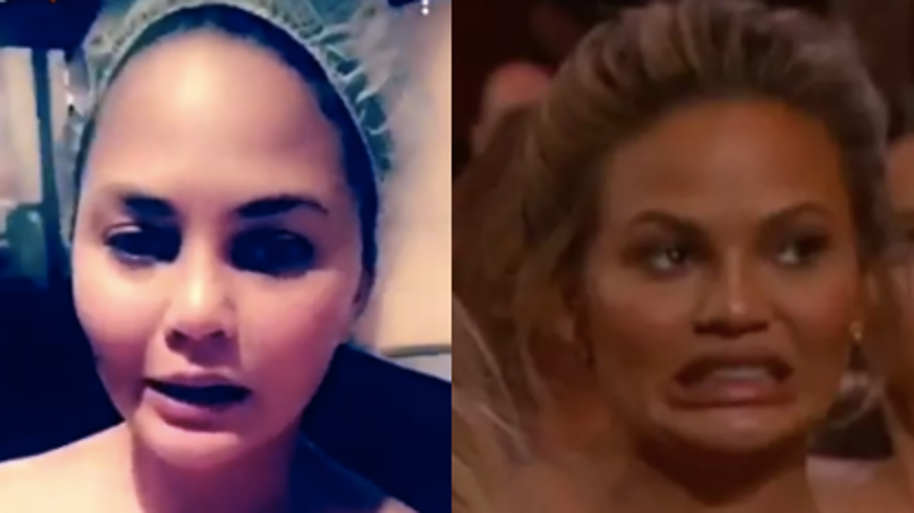 Chrissy Teigen Apologizes For Having Nipples After Accidental Nip Slip