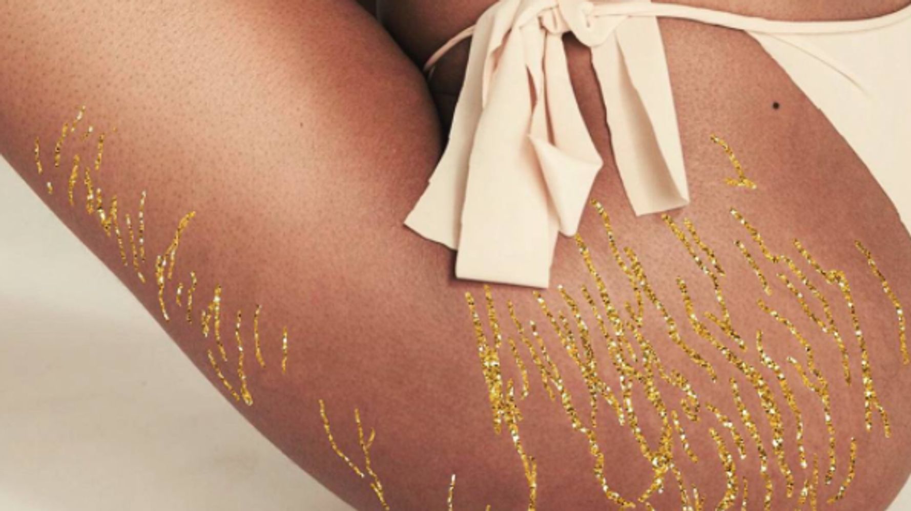 Woman Turns Stretch Marks Into Stunning Artwork With The Power Of