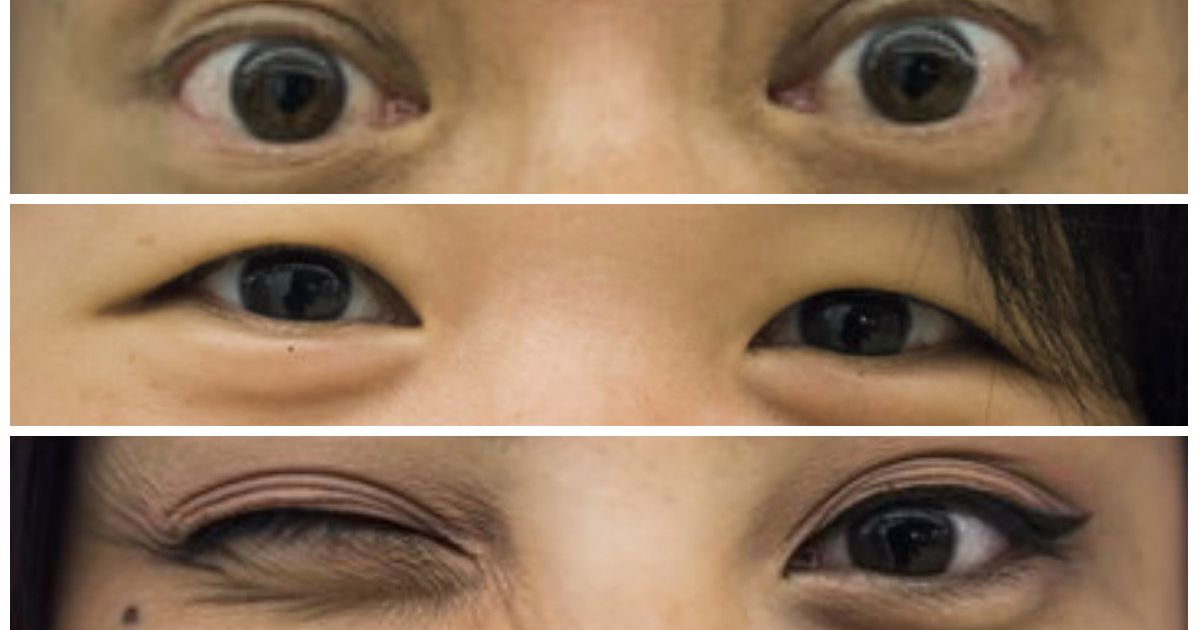 2. "The Fascinating Genetics Behind Dark Hair and Blue Eyes in Asians" - wide 4