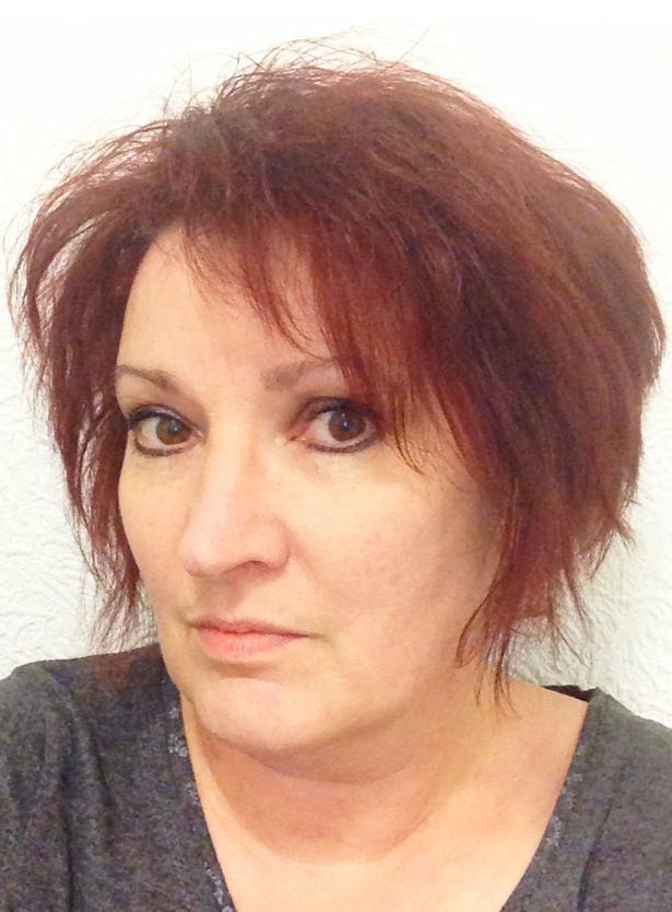 Epilepsy sufferer Louise Bolotin lost £307 overnight after being reassessed for PIP 