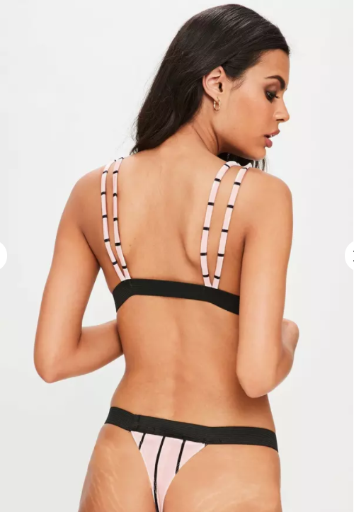 Missguided Applauded For Featuring Unretouched Photos Of Models With Stretch Marks - _