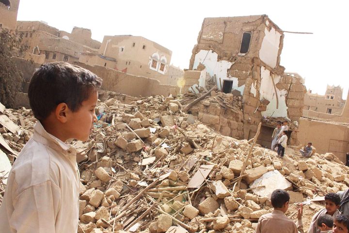 Children suffer in Yemen’s civil war.