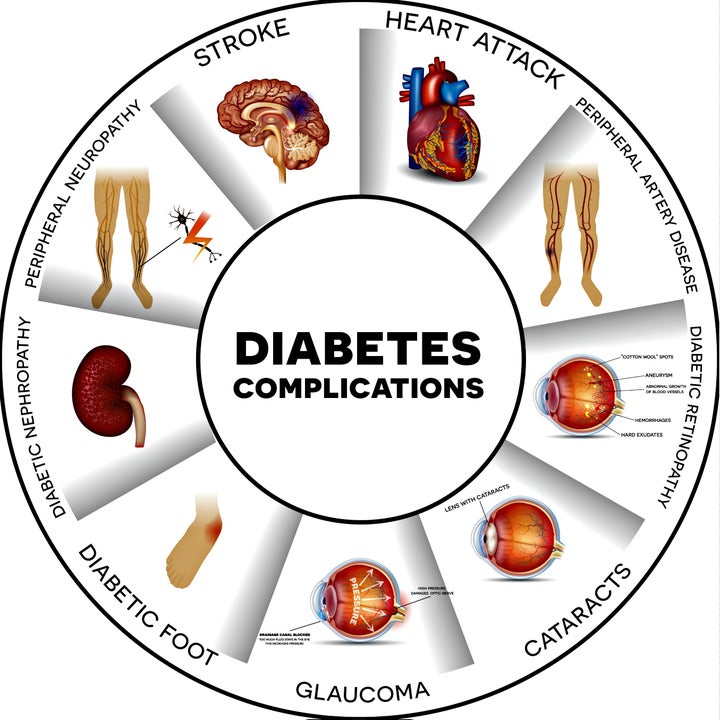 Complications of diabetes