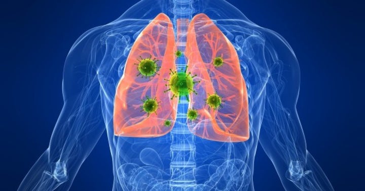 Influenza complicates management of diabetes.