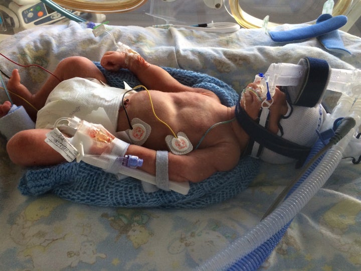 Zach was born 11 weeks early and weighed 3lb 9oz.