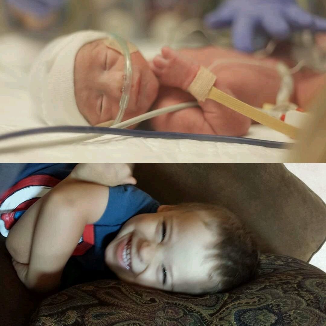 30 week baby premature