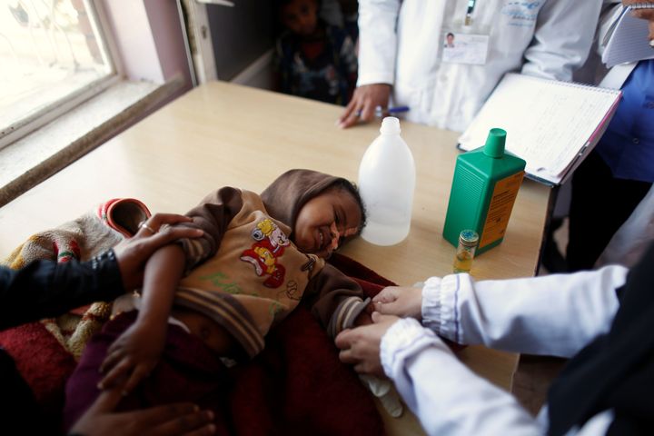 Malnutrition is increasingly common in Yemen, particularly among children.