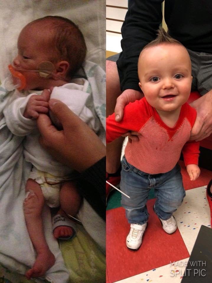 my premature baby is very active