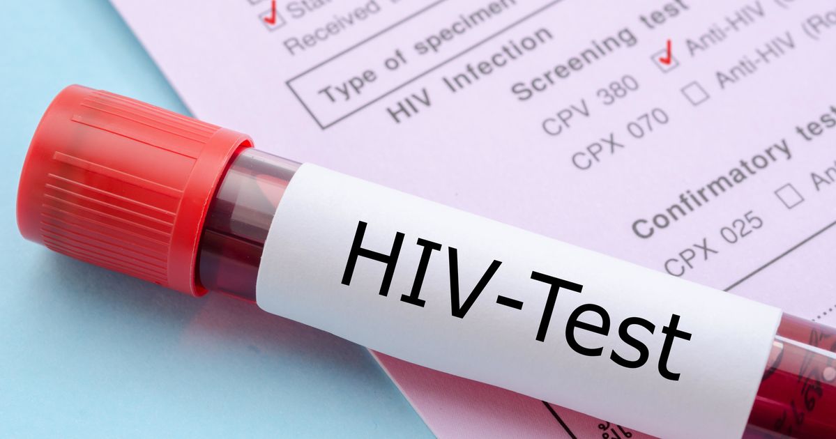 New HIV Cases In New York City Hit Record Low, Health Department Says ...