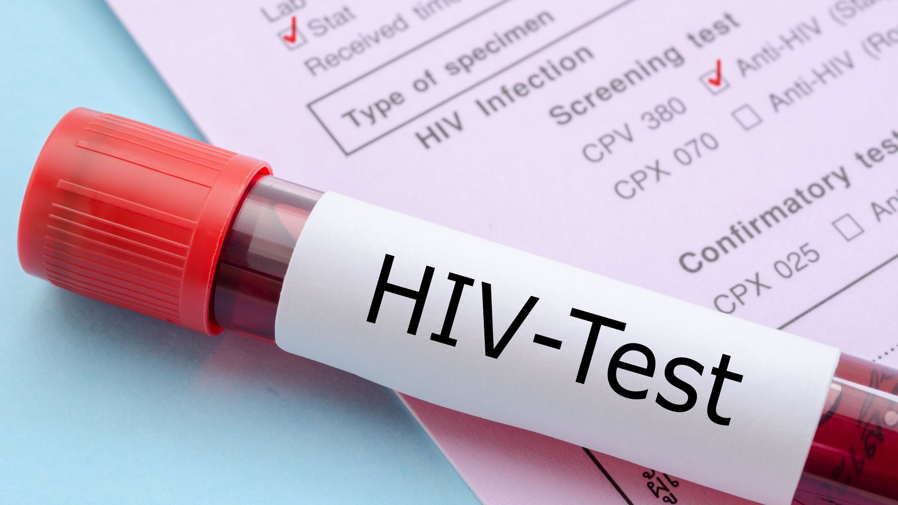 New Hiv Cases In New York City Hit Record Low Health - 