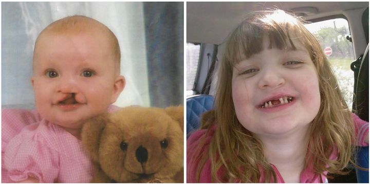 Ellie-Mae (L) as a baby and (R) now. 