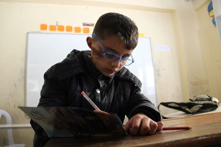 Nine-year-old Safi still bears the scars of a bombing attack on his school in Antakya, Syria