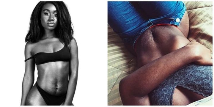 Talmesha Jones is a mother who is embracing her stretch marks and inspiring others with the hashtag #TigerStripesOnATuesday.