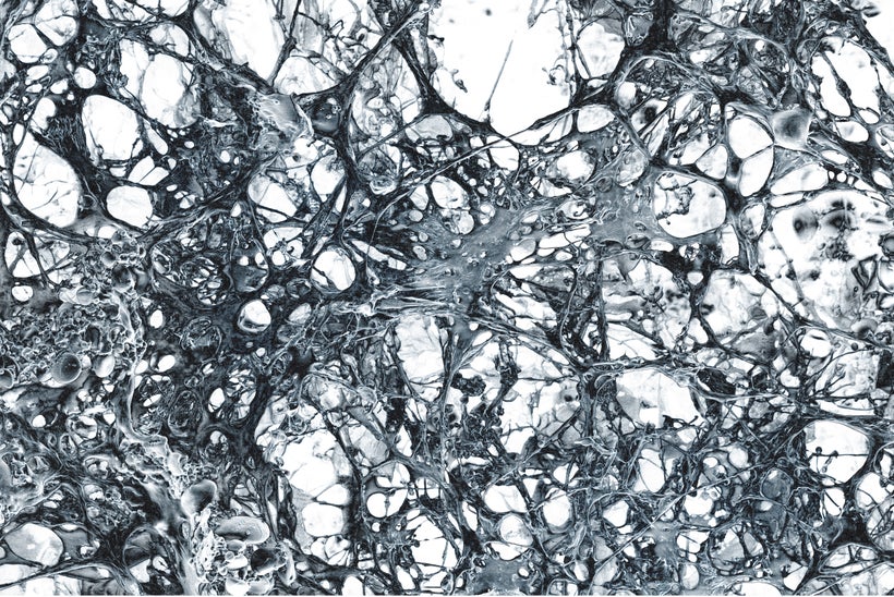 Gluten web, from <em>Modernist Bread </em>by Nathan Myhrvold and Francisco Migoya