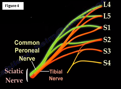 Slap Gait, Steppage Gait, and Foot Drop | HuffPost Contributor