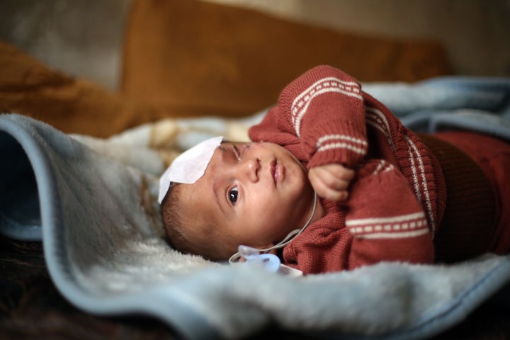 Karim Abdel Rahman lost an eye and his mother in government shelling in Eastern Ghouta.