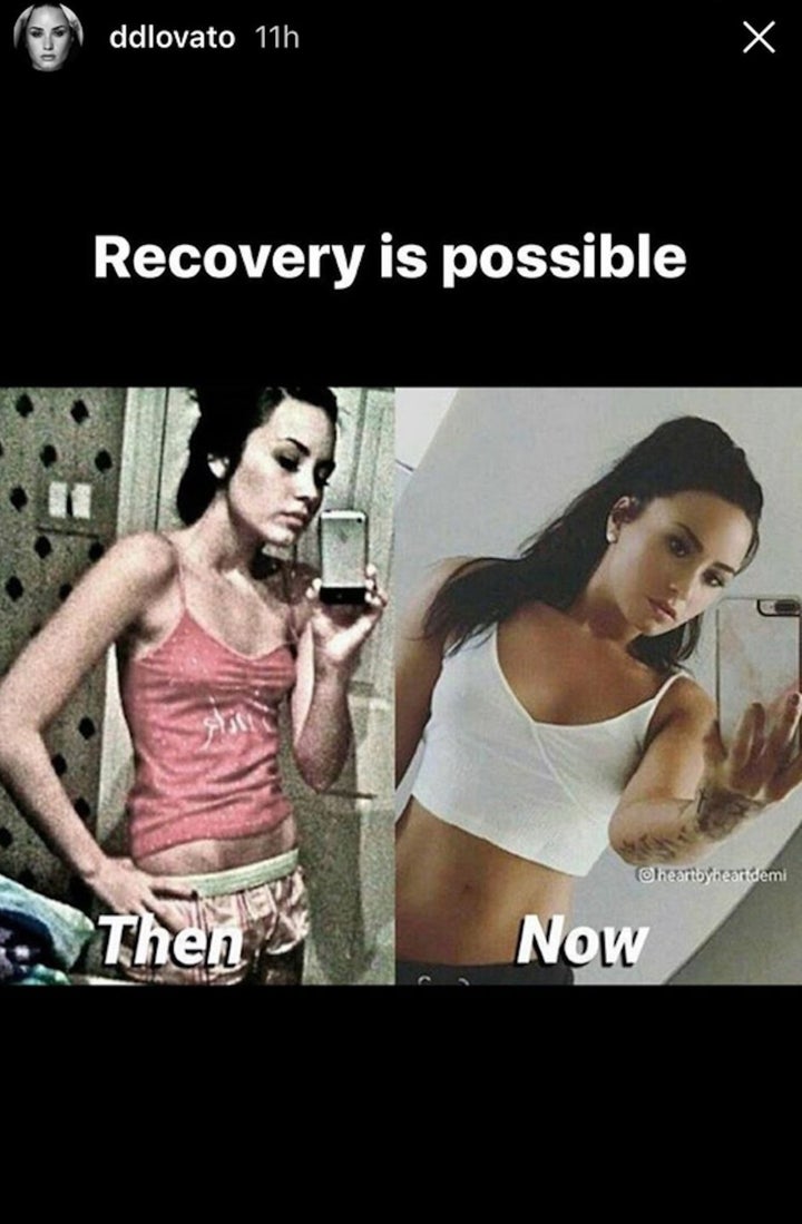 Demi Lovato Felt Insecure, But Posted This Bathing Suit Demi Lovato Felt Insecure, But Posted This Bathing Suit