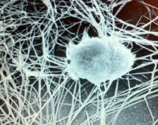 Follicular Dendritic Cell