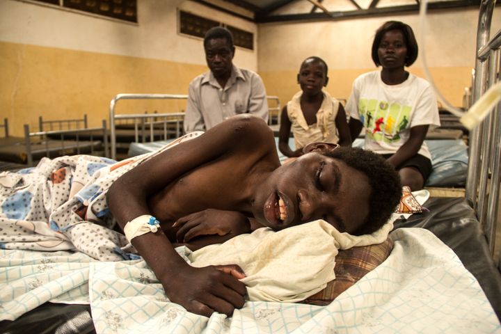 Okot Elson, 16, is one of three patients in the nodding syndrome ward at Kitgum Hospital in Uganda.