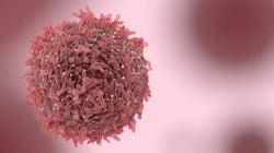 ‘What Is Cancer?’: Answering The Most Googled Health Question Of
