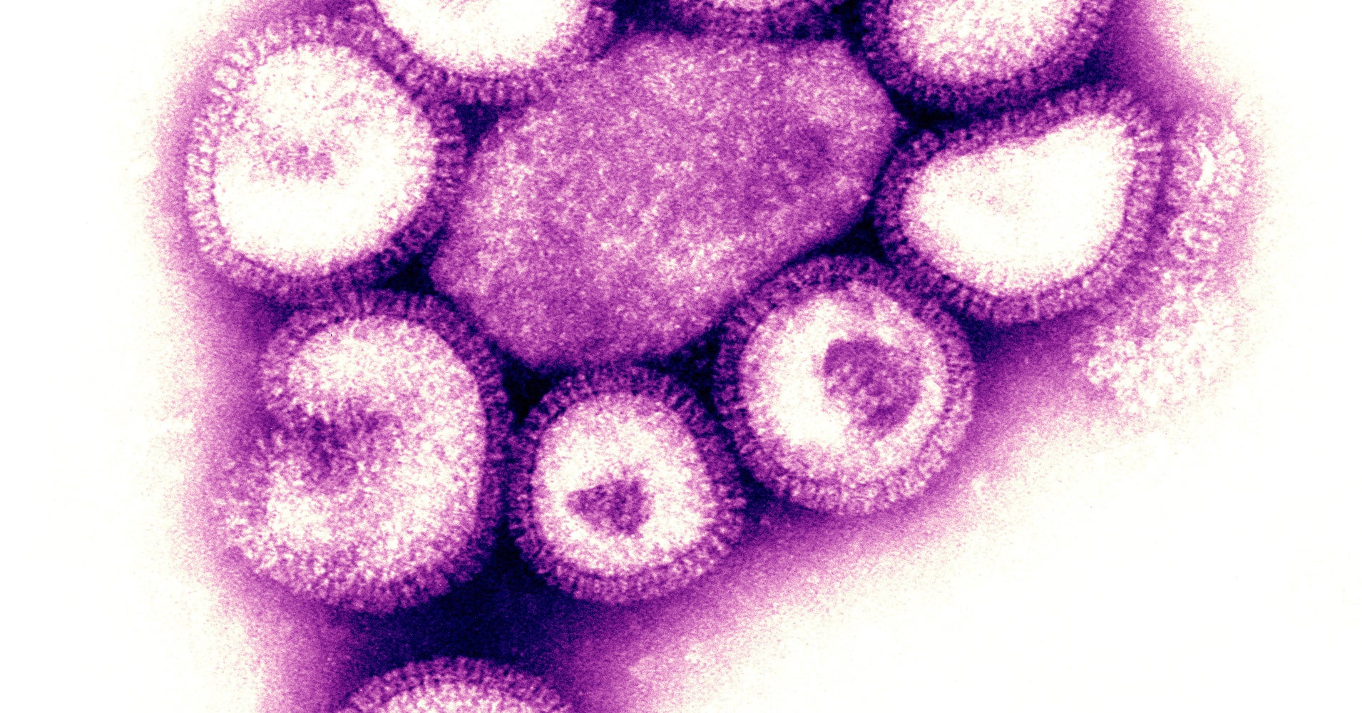 Flu Season Is Hitting Especially Early, Prompting Concerns From Health