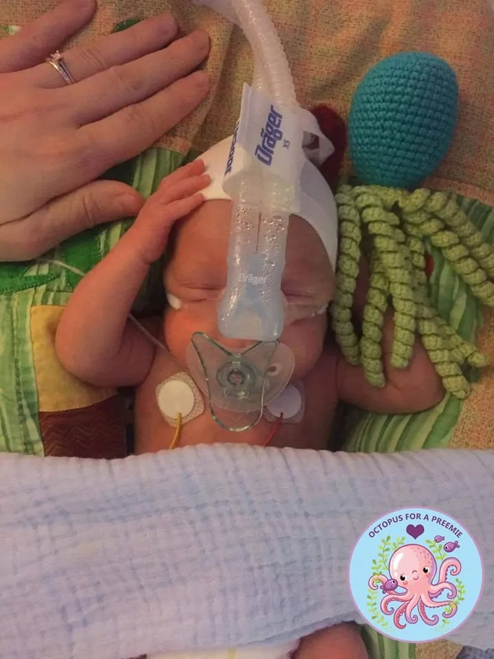 Octopus for nicu online babies