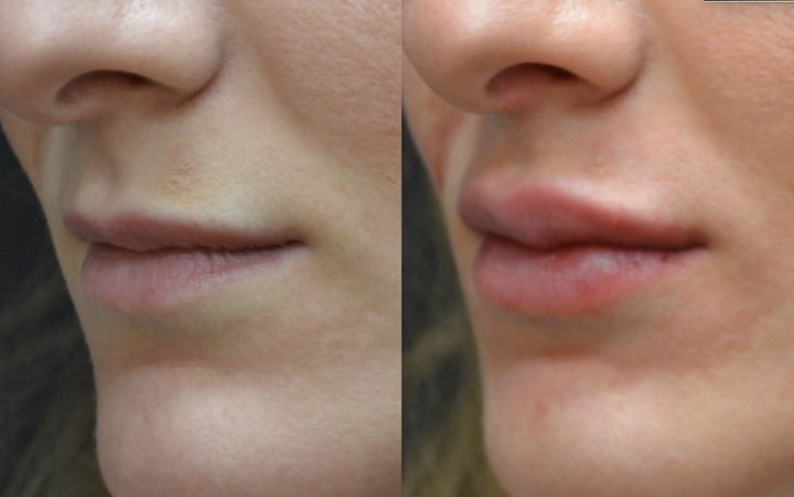 <p>Luscious Lips</p>