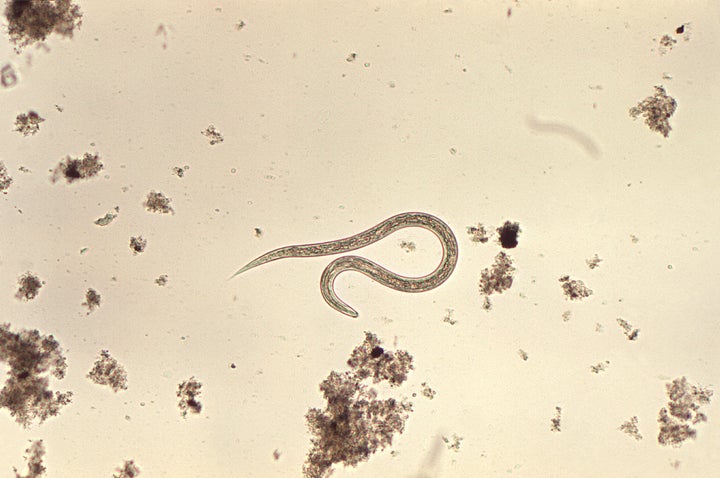 A hookworm parasite.