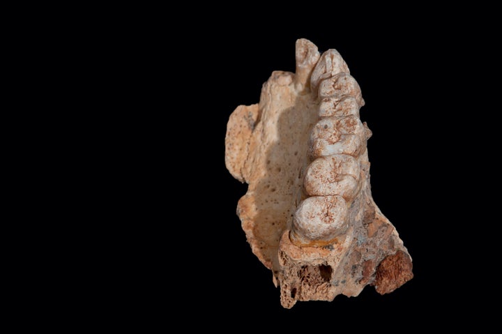 All teeth are present in the sample except the central incisor.